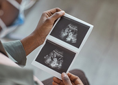 iStock/SeventyFour